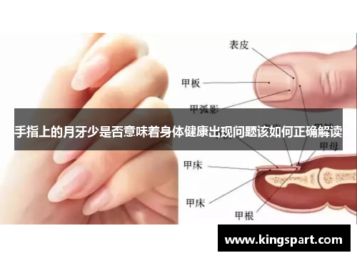 手指上的月牙少是否意味着身体健康出现问题该如何正确解读 手指上的月牙少是否意味着身体健康出现问题该如何正确解读